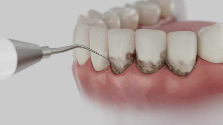 Trusted Dental Implants service in Westlake Village, CA - Dentist Open Now